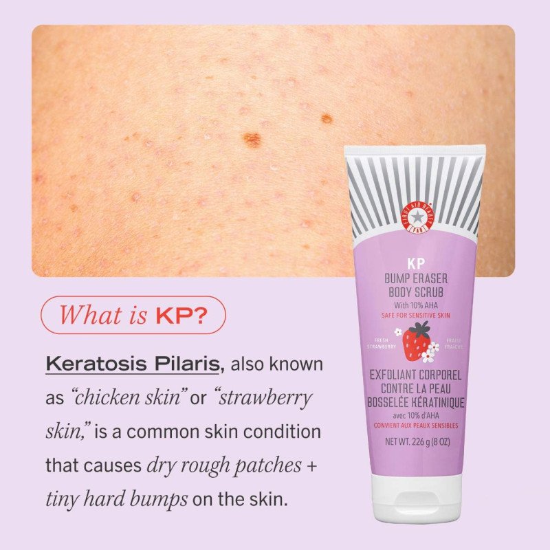 First Aid Beauty KP Bump Eraser Body Scrub with 10% AHA – Fresh Strawberry - Image 6
