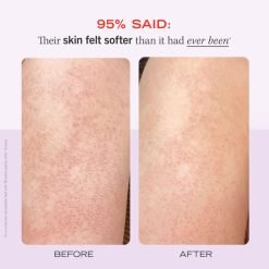 First Aid Beauty KP Bump Eraser Body Scrub with 10% AHA – Fresh Strawberry - Image 8