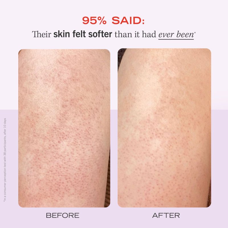 First Aid Beauty KP Bump Eraser Body Scrub with 10% AHA – Fresh Strawberry - Image 8